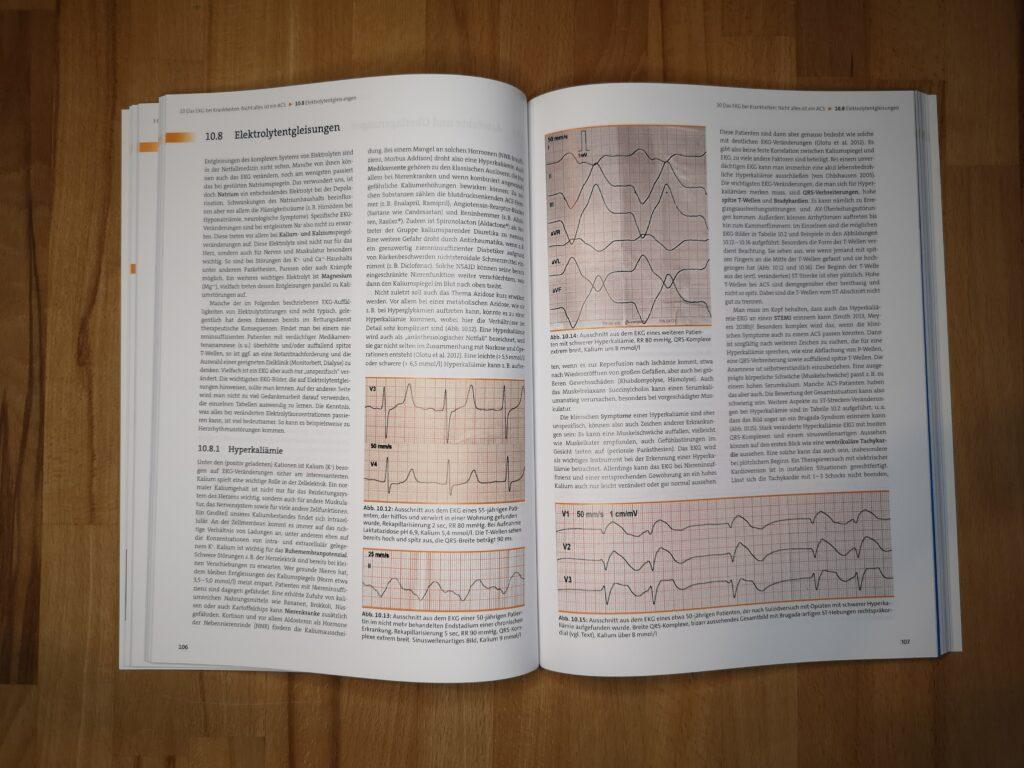 EKG in der Notfallmedizin (Rezension) 3 Zahlreiche EKG-Abbildungen
