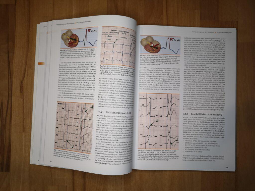EKG in der Notfallmedizin (Rezension) 2 EKG für Notfallsanitäter
